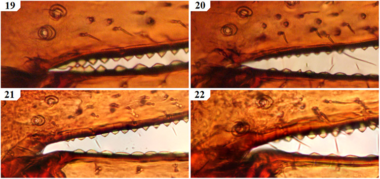 Tooth-morphology-at-the-base-of-the-chelal-fingers